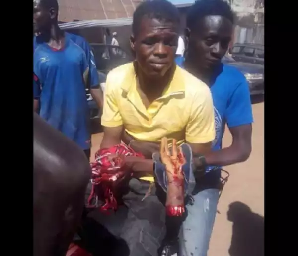 Shocking..! Hoodlums Cuts Off Young Man